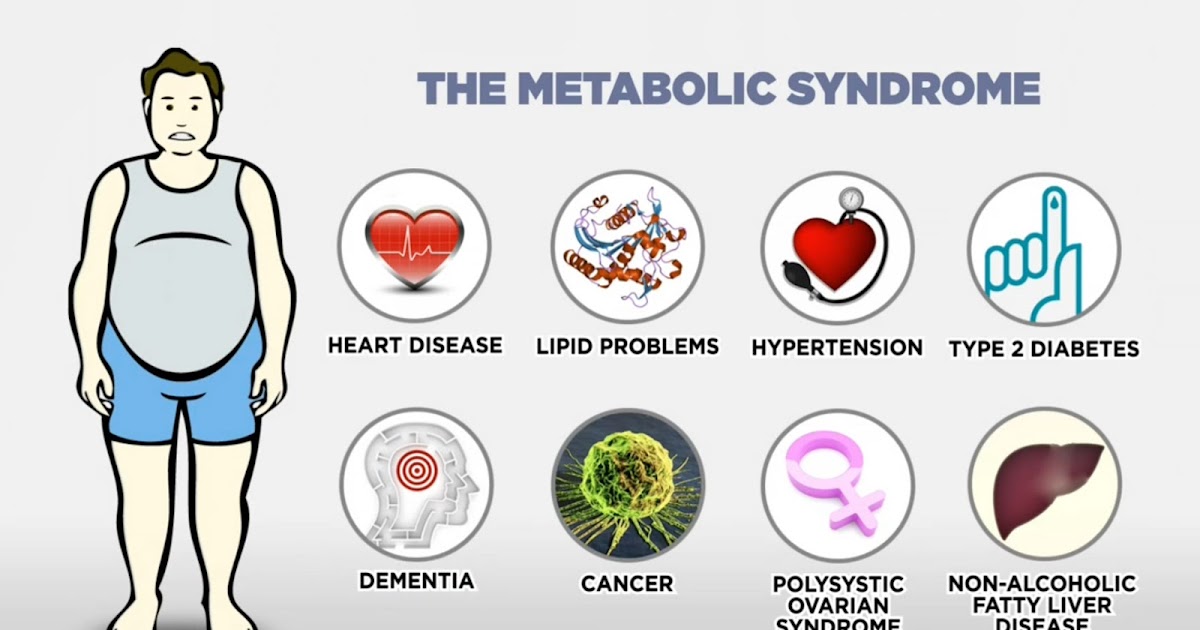 sindromul metabolic în imposibilitatea de a pierde în greutate