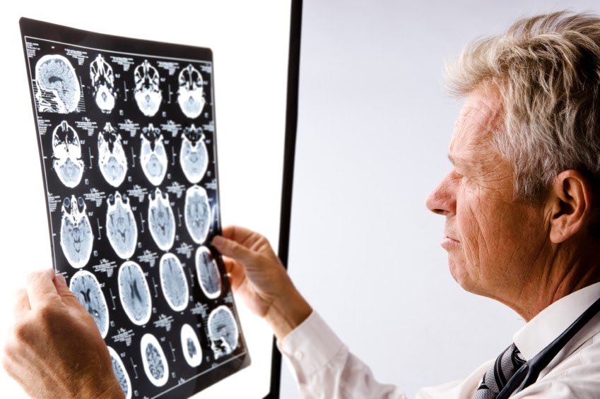 doctor-salary-neurologist-salary-in-usa
