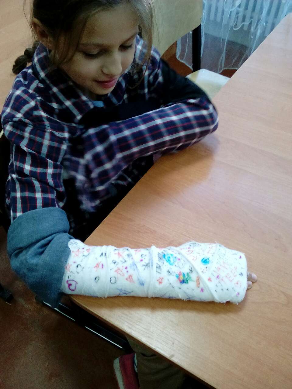 парень с заоманой рукой. перелом обеих рук. девушка сломала обе руки. перелом обеих рук. перелом обеих рук.