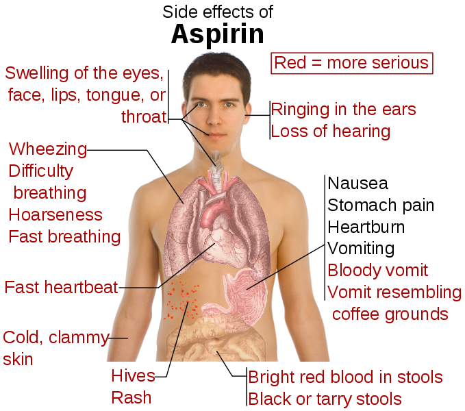 Dental Mnemonics Adverse Effect Of ASPIRIN