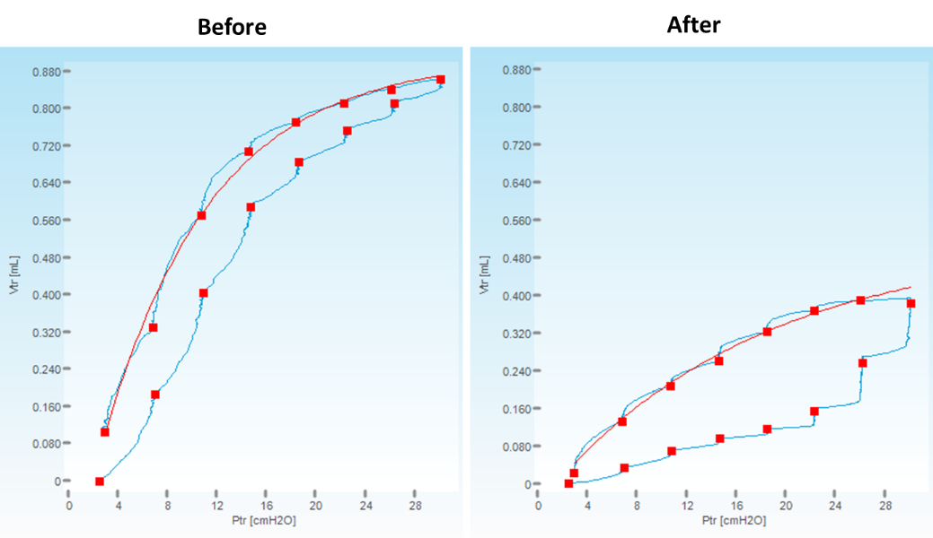 Pulmonary Hypertension Animal Models SCIREQ