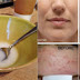 Get A Perfect Face With This Amazing Remedy!