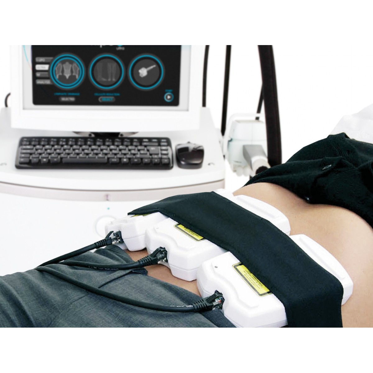 Лазерный липолиз для похудения