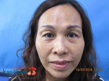 [Image: co%2Bnen%2Bcat%2Bmi%2Bmat%2Bkhong%2B1.3.jpg]