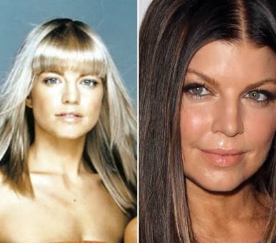 fergie Addicted to Plastic Surgery