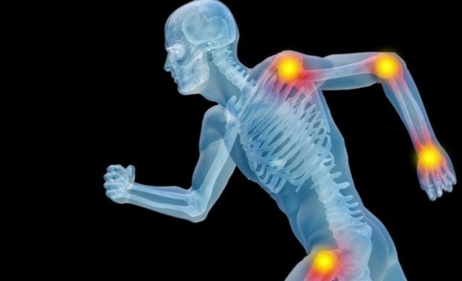 Pengertian Sendi Mati, Sendi Kaku, dan Sendi Gerak