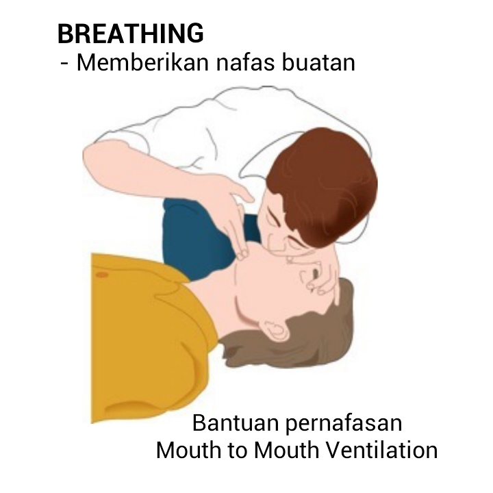 Agus teambedah Basic Life Support
