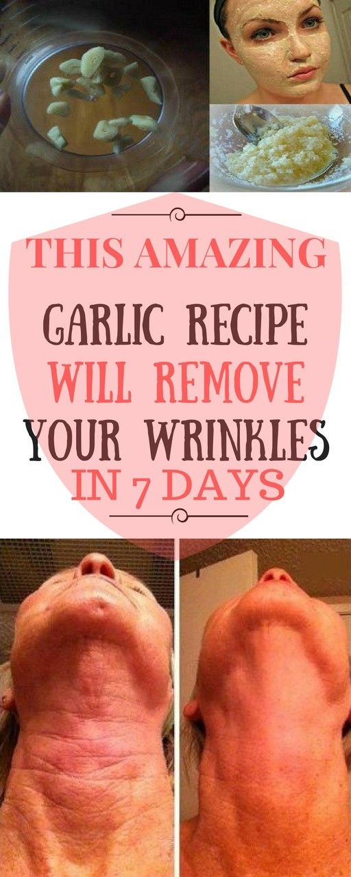 THIS AMAZING GARLIC RECIPE WILL REMOVE YOUR WRINKLES IN 7 DAYS