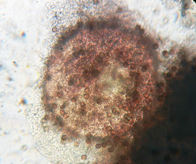 perithecium of Nectriopsis violacea and Fuligo septica spores