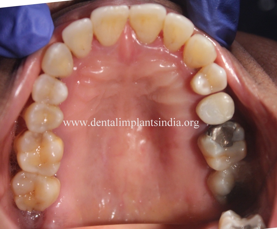 Chinthamani Laser Dental Clinic DENTAL TOURISM IN CHENNAI INDIA FOR