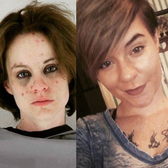 Brooke's first dealer was actually a doctor. The woman has tried to quit 12 times. - Powerful Before/After Photos Of Women Who QUIT Drugs. Brooke's first dealer was actually a doctor. The woman has tried to quit 12 times. - Powerful Before/After Photos Of Women Who QUIT Drugs.
