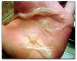 Foto Apa nama obat gonore yang dijual di apotik berkah