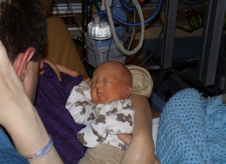 An infant diagnosed with Potter's syndromePotter's syndrome photos