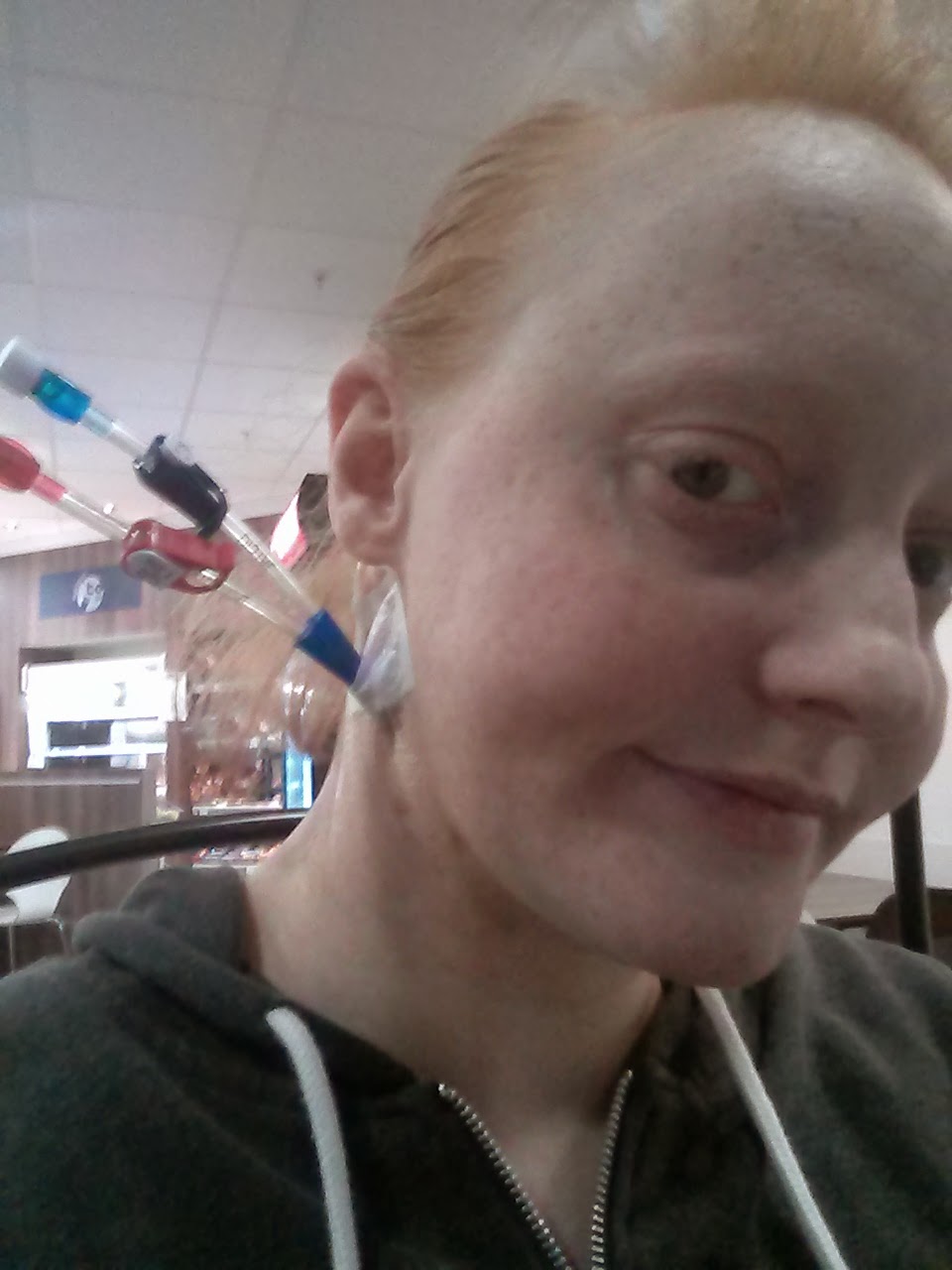 The Girl on Dialysis