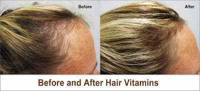 Healthy Hair Vitamins