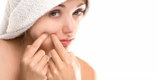 Acne Treatments For Girls