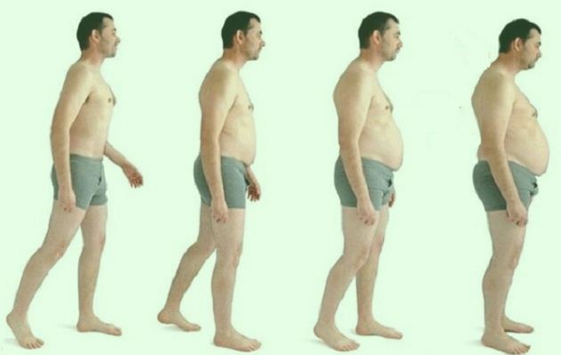 Obesitas Anak Karena Minuman Ringan Soft Drink Obesitas Anak Karena Minuman Ringan Soft Drink