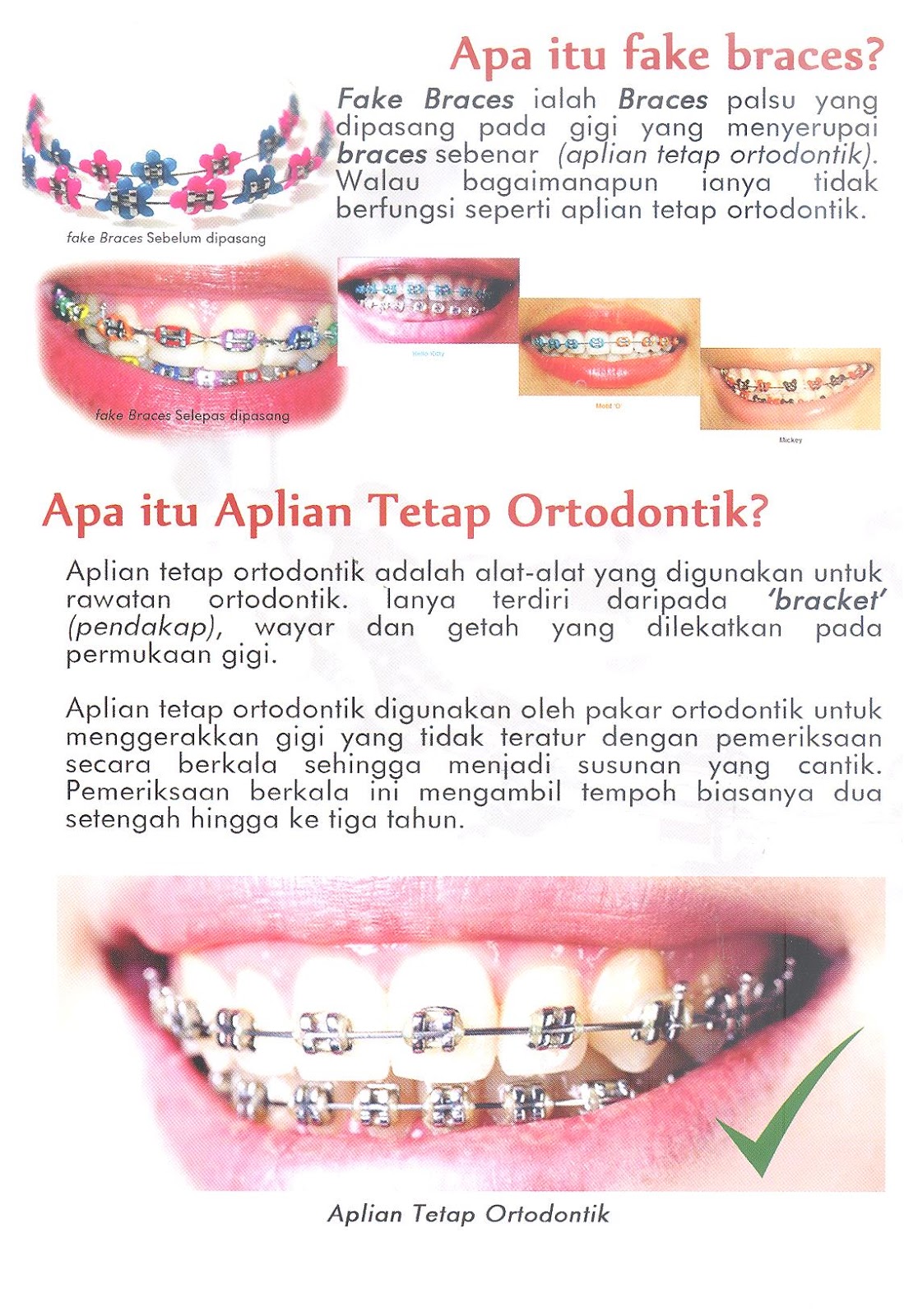 Ortodontik maksud