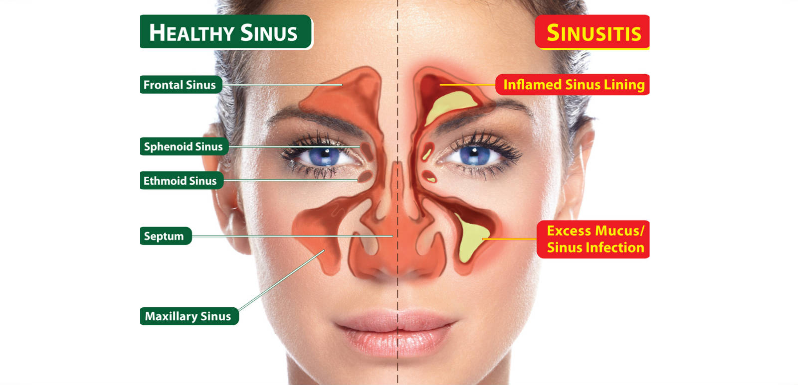 When Do Sinuses Develop In Babies?