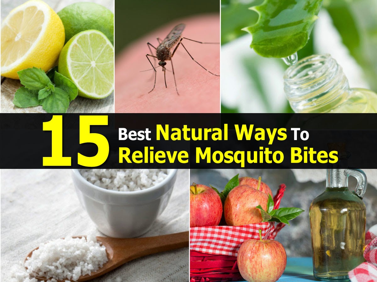 15 Best Natural Ways To Relieve Mosquito Bites Handy DIY
