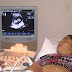 FIQUE SABENDO! / Moradora de Irecê engravida naturalmente de quadrigêmeos