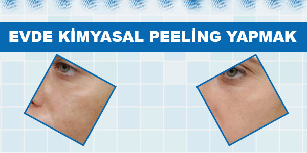 Kimyasal Peeling Kimyasal Peeling