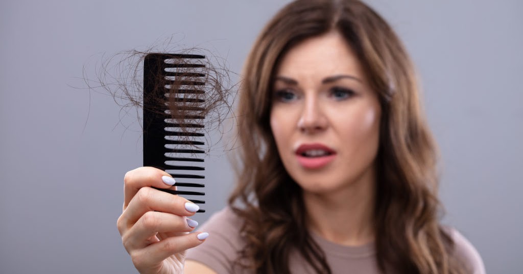 Telogen Effluvium (TE) 7 Natural Ways To Treat This Common Hair Loss