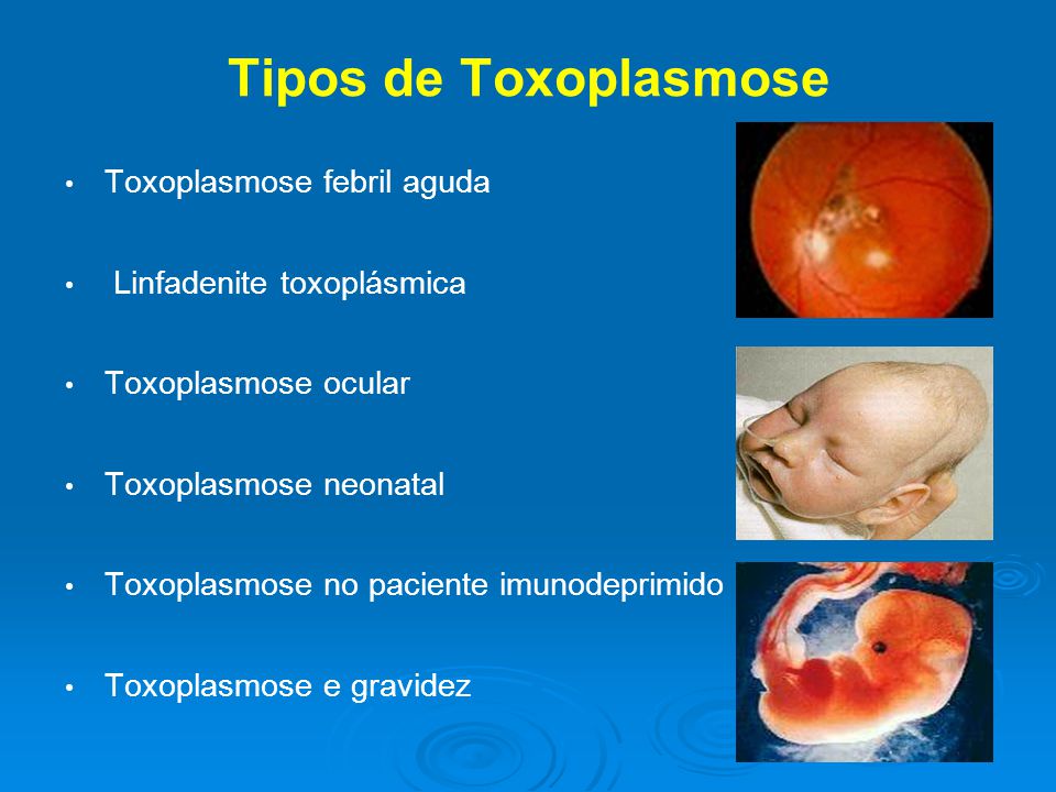 Toxoplasmose Causas E Sintomas Dicas Aqui