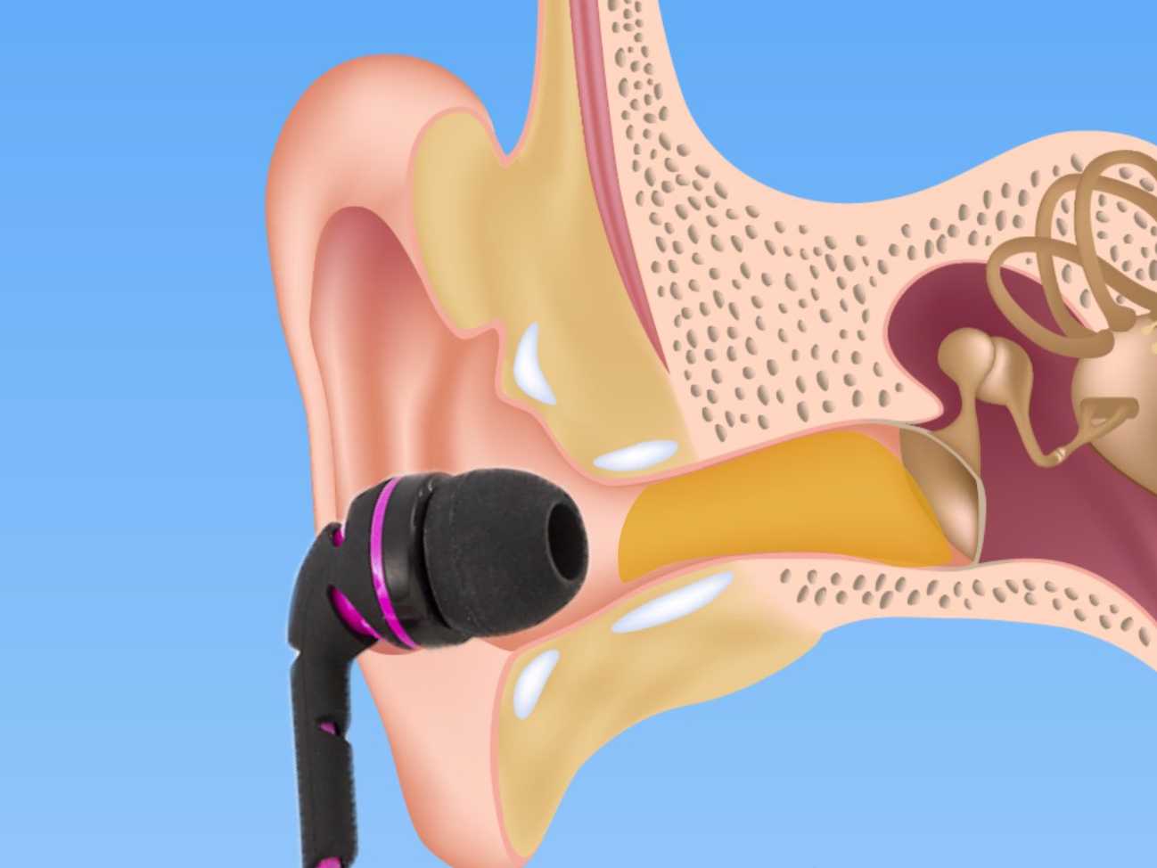 What would happen if you never took out your earbuds? LancerVJ