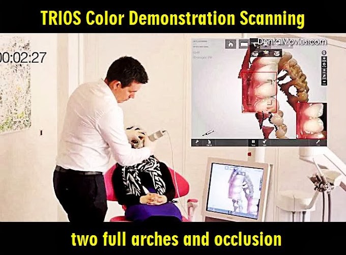 TRIOS Color Demonstration Scanning two full arches and occlusion