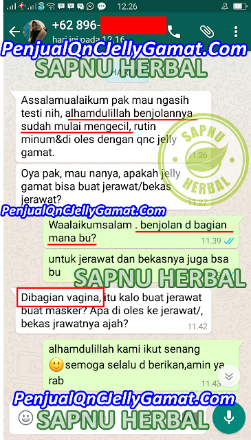 Obat Benjolan di Vagina di Apotik Paling Ampuh & Aman utk Semua Usia Obat Benjolan di Vagina di Apotik Paling Ampuh & Aman utk Semua Usia