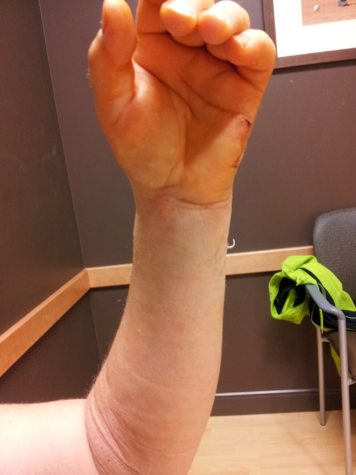 Mustang Dreams.... Post first surgery....