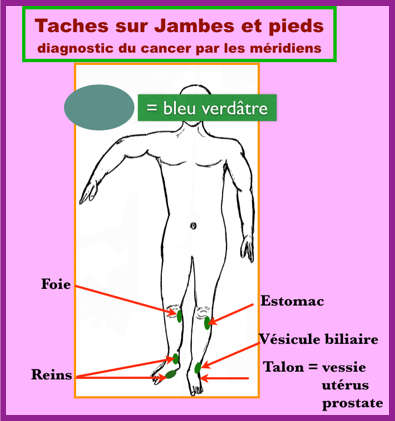 La douleur stupide à gauche au côté au dessous du dos