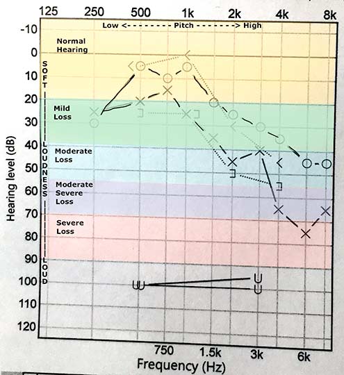 Hearing Test Chart
