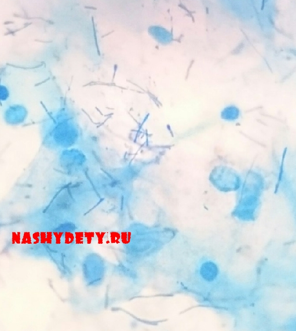 Коринебактерии дифтерии в мазке. C. Дифтероиды в мазке на флору. Дифтероиды микроскопия. Дифтероиды в мазке на флору.