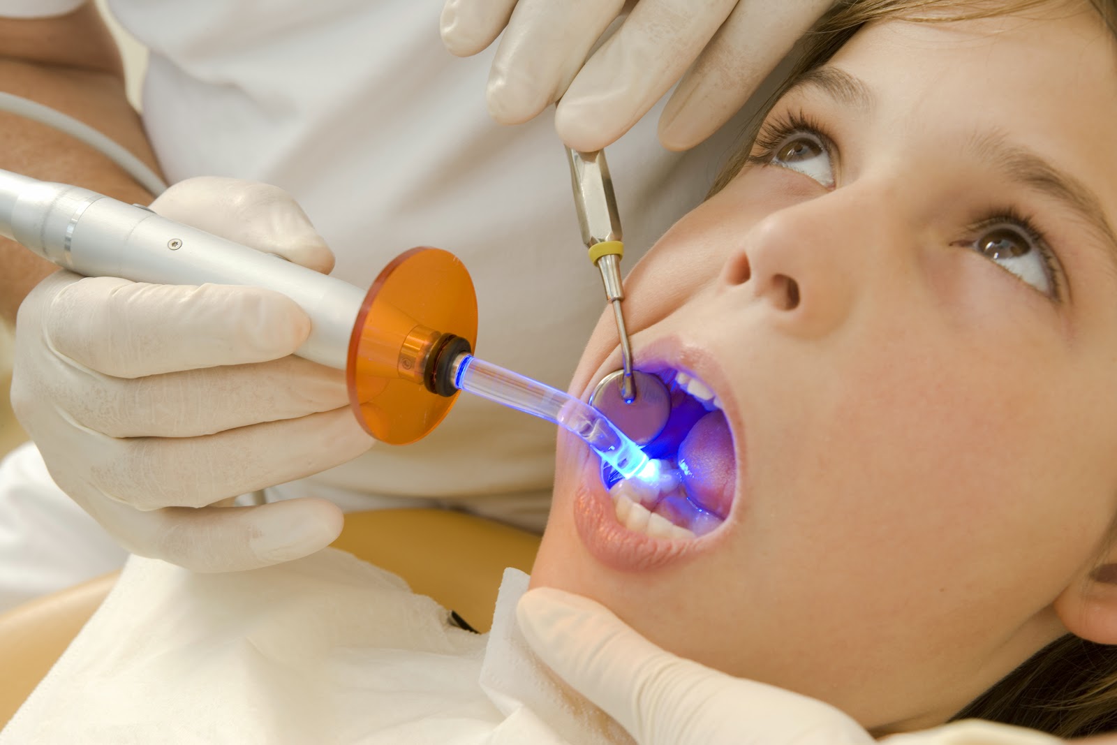 Go Dental Your Valencia Dentist The Pros and Cons of Fillings
