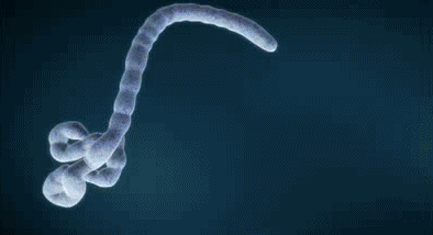 Ebola Salgını Nedir? Ebola Virüsü Nedir?