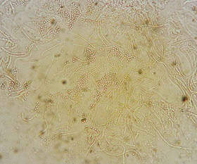 Biatorella resinae spores