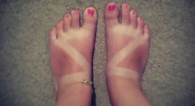 Sunbathing - Ηλιοθεραπεία