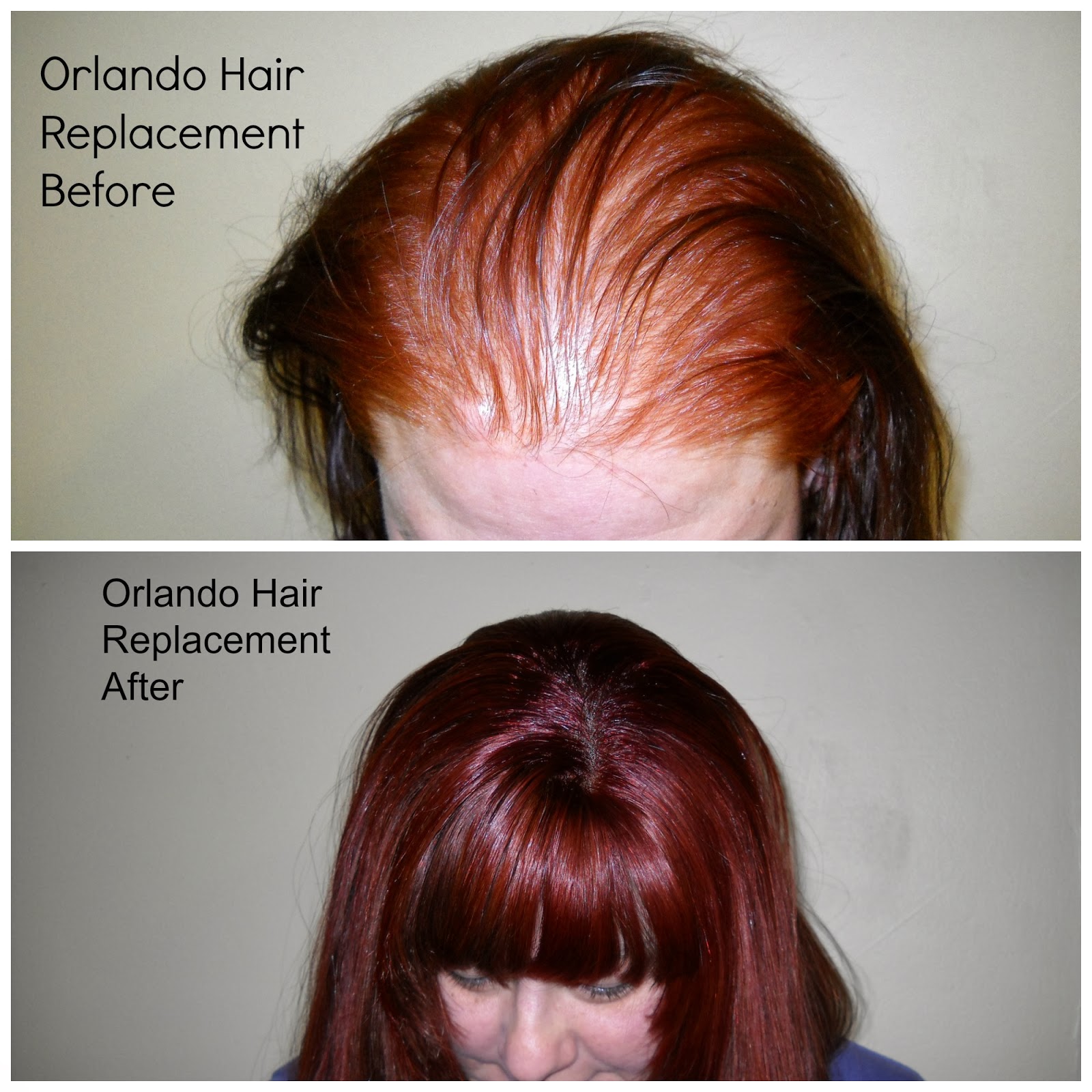 Braidless Sew In Hair Extensions Orlando Braidless Sew In Hair