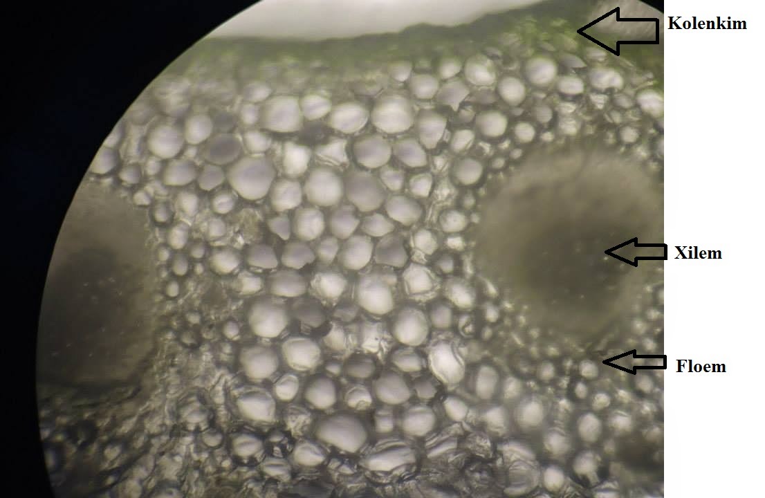Anpertum (Hasil Pengamatan Mikroskop) Macammacam Anpertum (Hasil Pengamatan Mikroskop) Macammacam