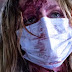 Cabin Fever: Patient Zero, 2014. Trailer legendado. Terror.