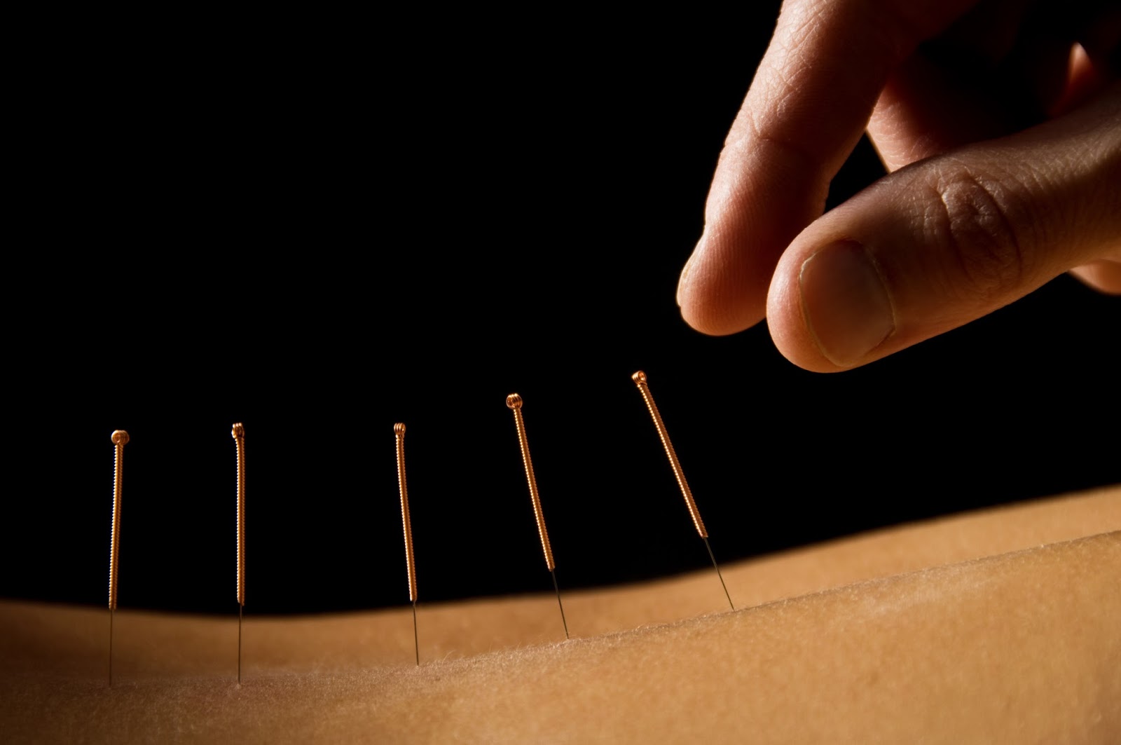 What Can Acupuncture Treat? Health Guide