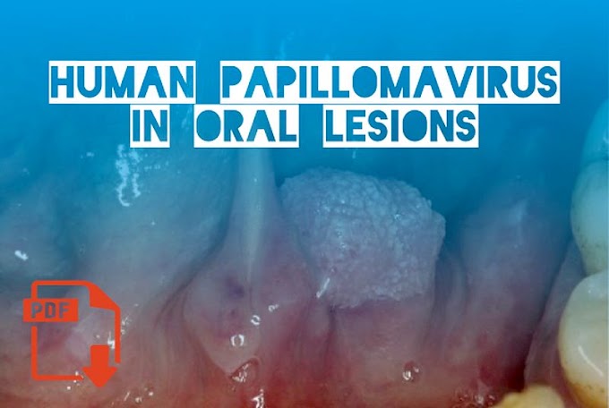 PDF: Human Papillomavirus in oral lesions