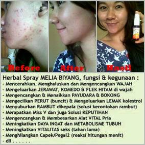 melia biyang kecantikan melia biyang kecantikan