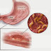 Cách phòng tránh bệnh dạ dày do vi khuẩn HP 
