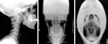 Conhecendo um pouco da Atlas Orthogonal