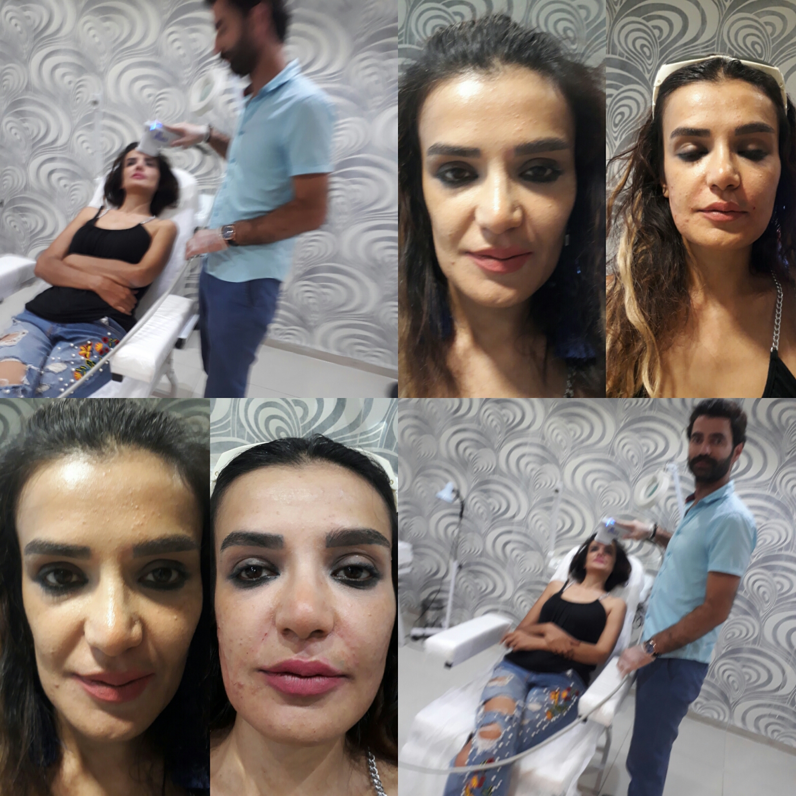Ulthera Ultherapy Maltepe