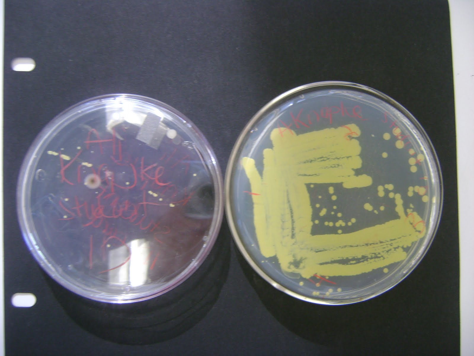 MedicALI Microbiology Preparing and Staining a Bacterial Smear