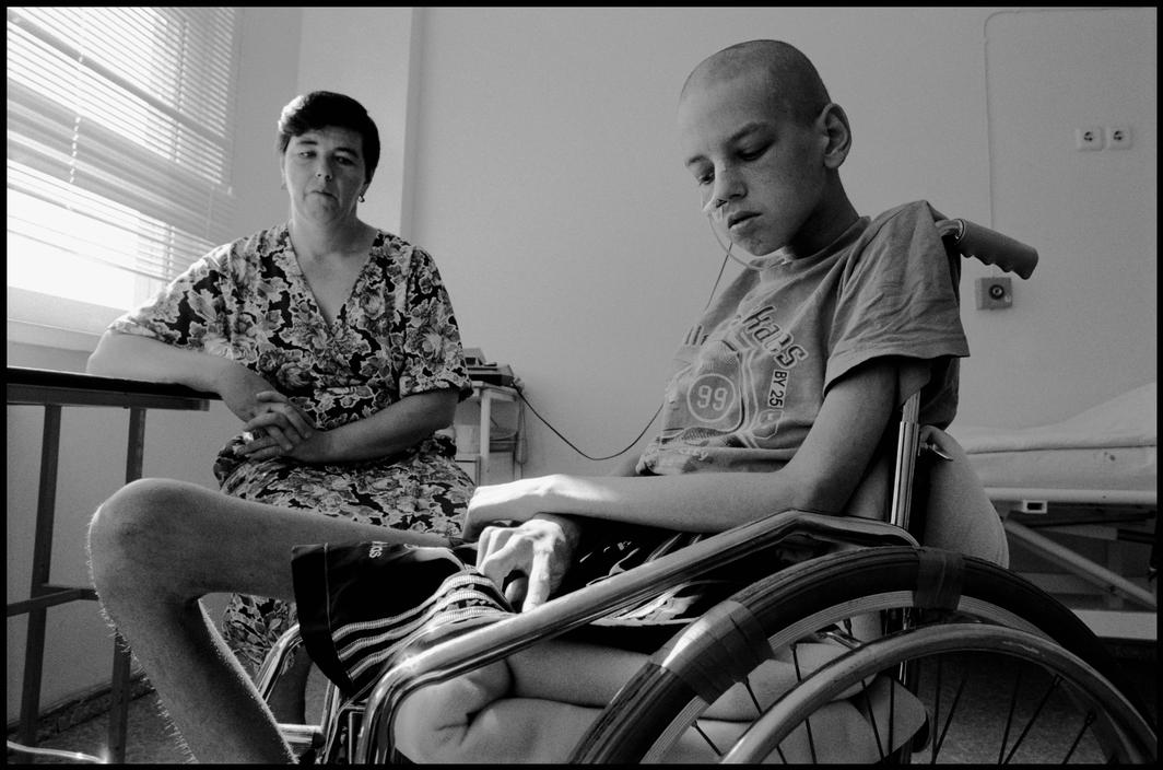 Военные инвалиды по заболеванию. Дети Чернобыля лучевая болезнь. Дети инвалиды Чернобыля.